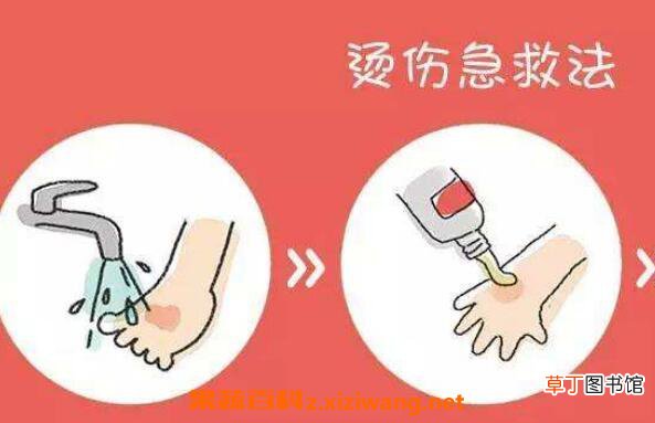 烫伤后怎样恢复得快 烫伤疤痕如何消除