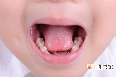 舌头发红没有舌苔是怎么回事-舌头发红没有舌苔是什么原因