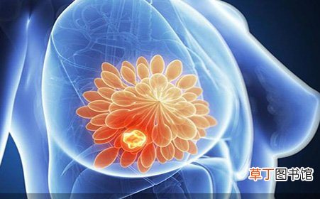 乳癌2阳一阴这种好吗-乳癌2阳一阴是什么情况
