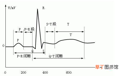 心电图t波改变-心电图t波改变是怎么回事呢