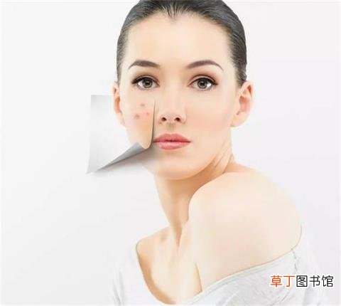 女性怎样防止青春痘产生-女性防止青春痘产生的方法