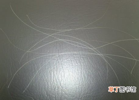 年轻人长白头发是什么原因-长白头发可能和四个因素有关