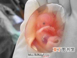人工流产后为什么身体很虚 人工流产后身体很虚弱怎么办呢