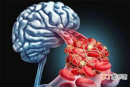 脑梗塞是什么病-脑梗塞是什么原因造成的