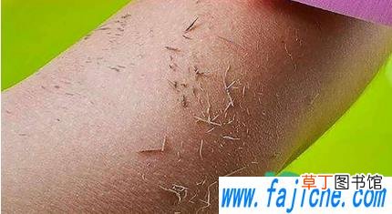 搓澡巾搓完痒什么原因 搓澡巾会把皮肤搓坏吗