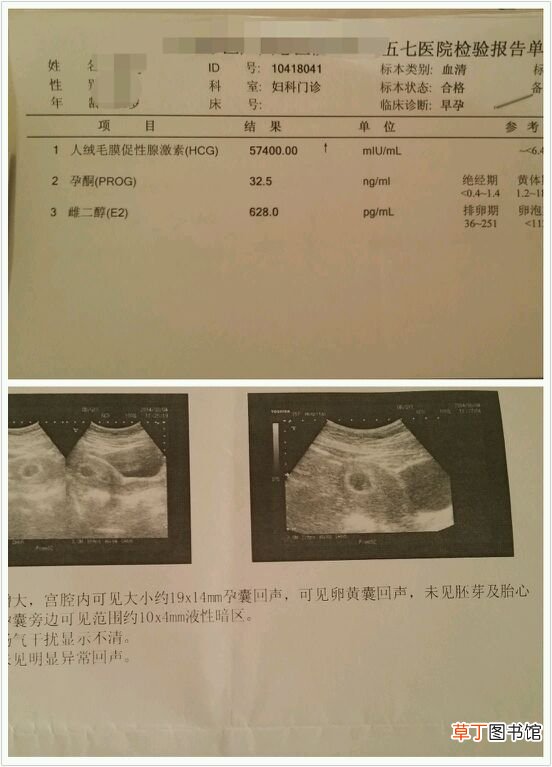 没有胎心下次怎么预防 怎样预防胎儿没有胎心胎芽