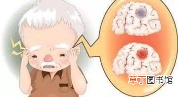 脑梗塞的症状及前兆-脑梗塞的症状及前兆有哪些