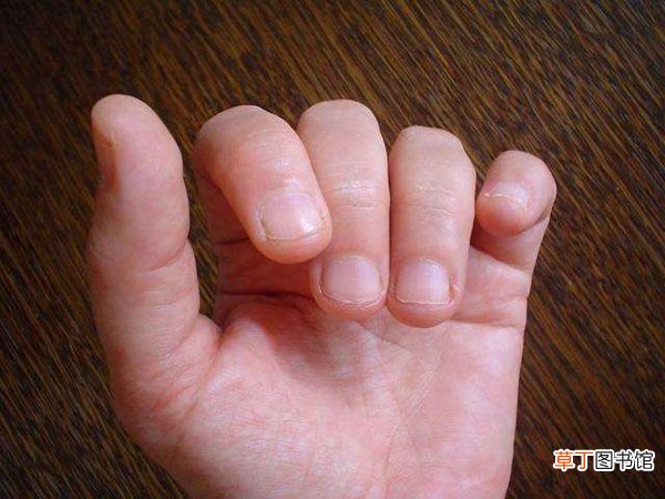 小孩咬手指甲解决办法 如何改掉孩子咬指甲的最好方法