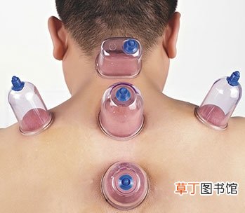 冬季拔火罐能治疗3种疾病9类人不宜