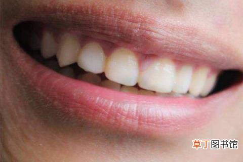 洗牙应该隔多久去一次 洗牙多久一次