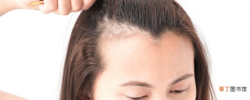 女生发际线为什么后移 女生发际线后移的原因