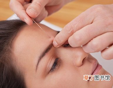 月经不调针灸可以吗? 谨记针灸要点