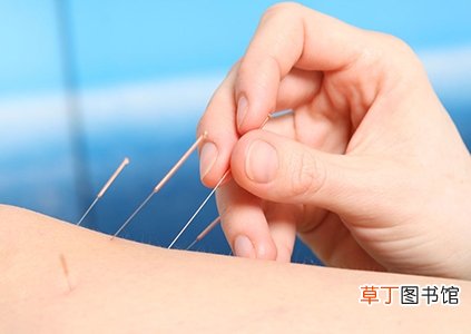 月经不调针灸可以吗? 谨记针灸要点