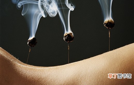 月经不调针灸可以吗? 谨记针灸要点