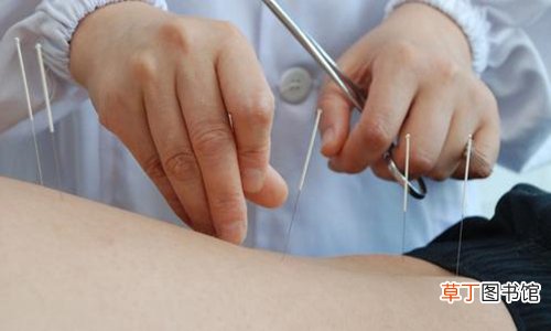 中医养生常识：针灸取穴的诀窍和四个取穴方法