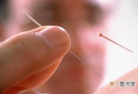 针灸的功效有哪些 中医用好一根针保养身体防疾病