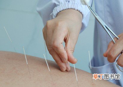 针灸的功效有哪些 中医用好一根针保养身体防疾病