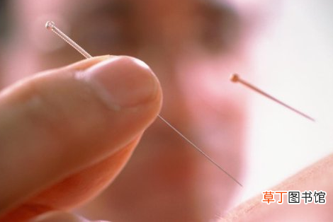 什么病不能针灸-针灸注意事项