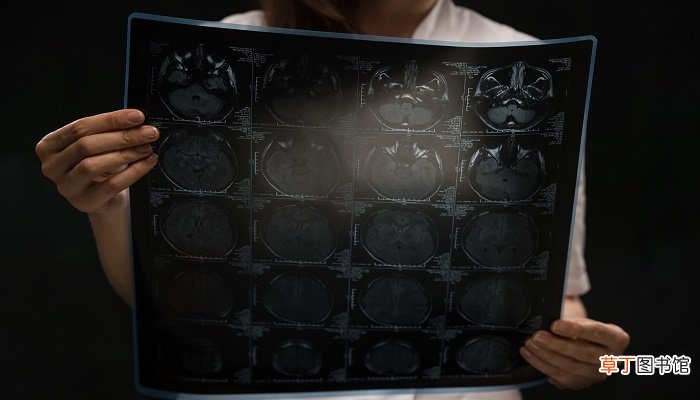 cr是什么意思