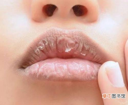 这些小习惯让你变得越来越丑，为了你的颜值一定要改掉