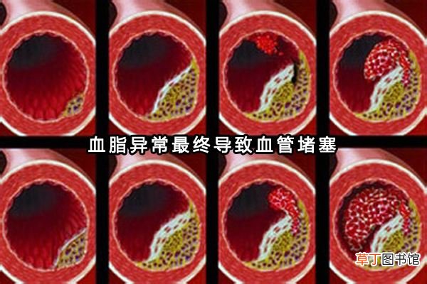 患高血脂人群越来越多，多吃这6种食物可以有效预防