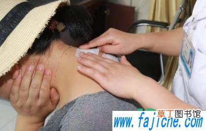 小孩贴三伏贴起泡了怎么办 儿童贴三伏贴的危害