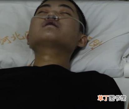 怀疑百草枯中毒怎么查 百草枯中毒能活多久