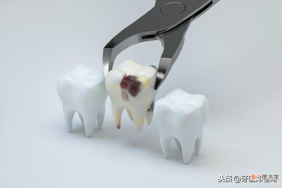 拔完牙几天能过感染期 拔完牙多久能好