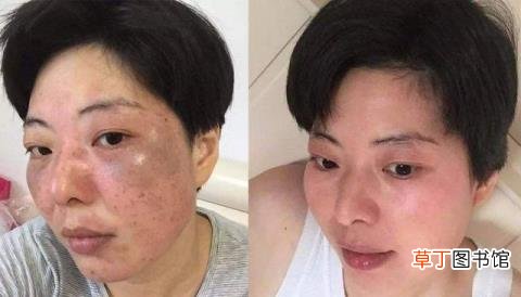 长期用煮鸡蛋滚脸美白 蛋清敷脸多久