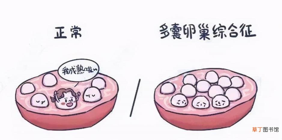 打促排卵针卵泡不长怎么办 促排卵针打后多久排卵