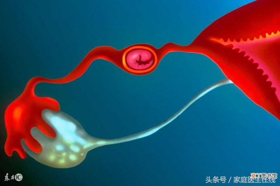 女人人流后多久会怀孕 做人流多久能怀孕