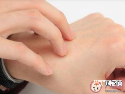 蚂蚁庄园8月15日答案 被蚊子咬了用指甲在蚊子包上画十字止痒是好方法吗
