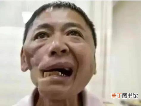 一年吃一次槟榔没事吧 槟榔吃多久
