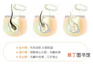 冰点脱毛后多久能碰水 脱毛维持多久