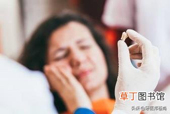 拔四颗牙矫正多久填满 拔颗牙要多久