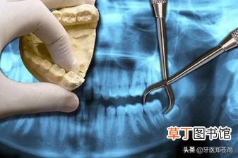 拔四颗牙矫正多久填满 拔颗牙要多久