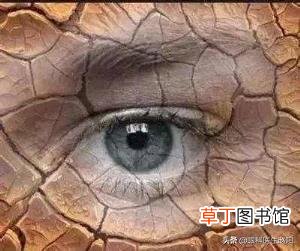 做完opt嫩肤后的注意事项 opt多久做一次