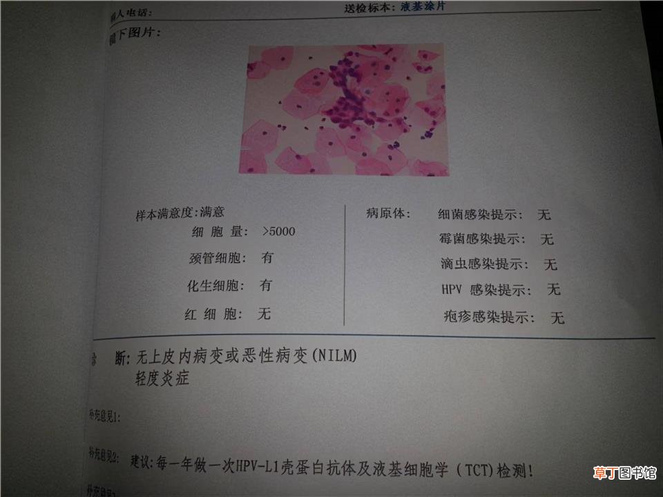 慢性阴炎可否自愈 阴道炎用药多久