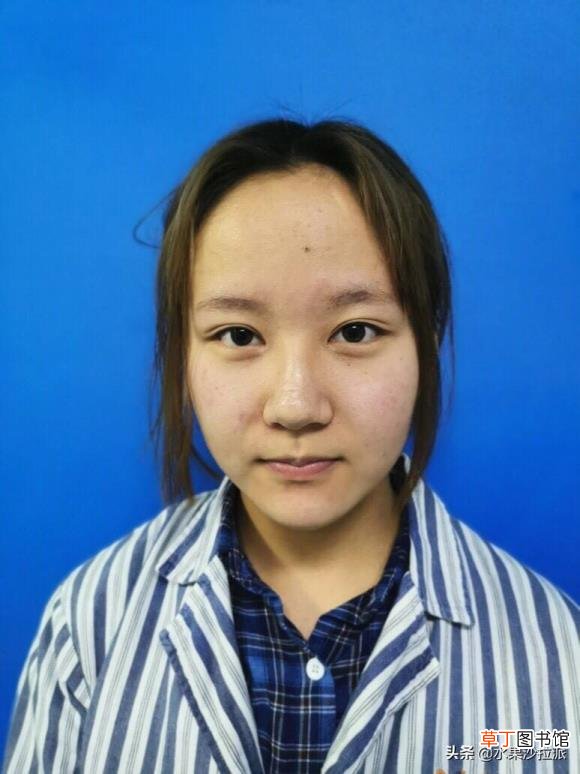隆鼻后拆线疼吗 隆鼻后疼多久