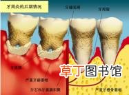大牙齿松动了能恢复吗 牙齿多久会掉