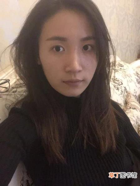 隆鼻消肿后鼻子会矮多少 鼻头多久消肿