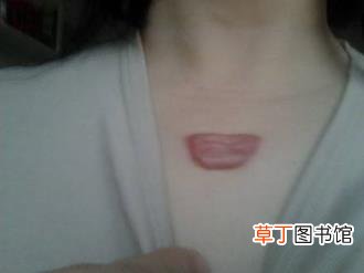 疤掉了有红印多久会消掉 疤多久会消失