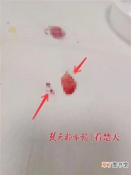 指甲完全换掉需要多少时间 拔指甲需要多久