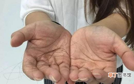 职业女性经常性掉发的原因脱发的饮食调理