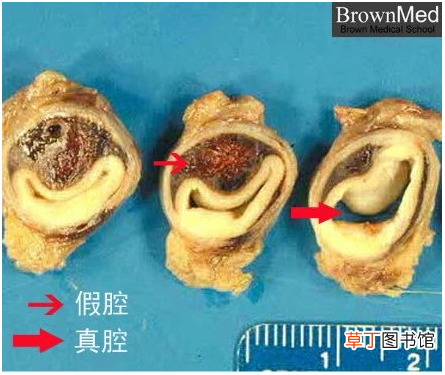 心血管系统 心血管系统详解知识点