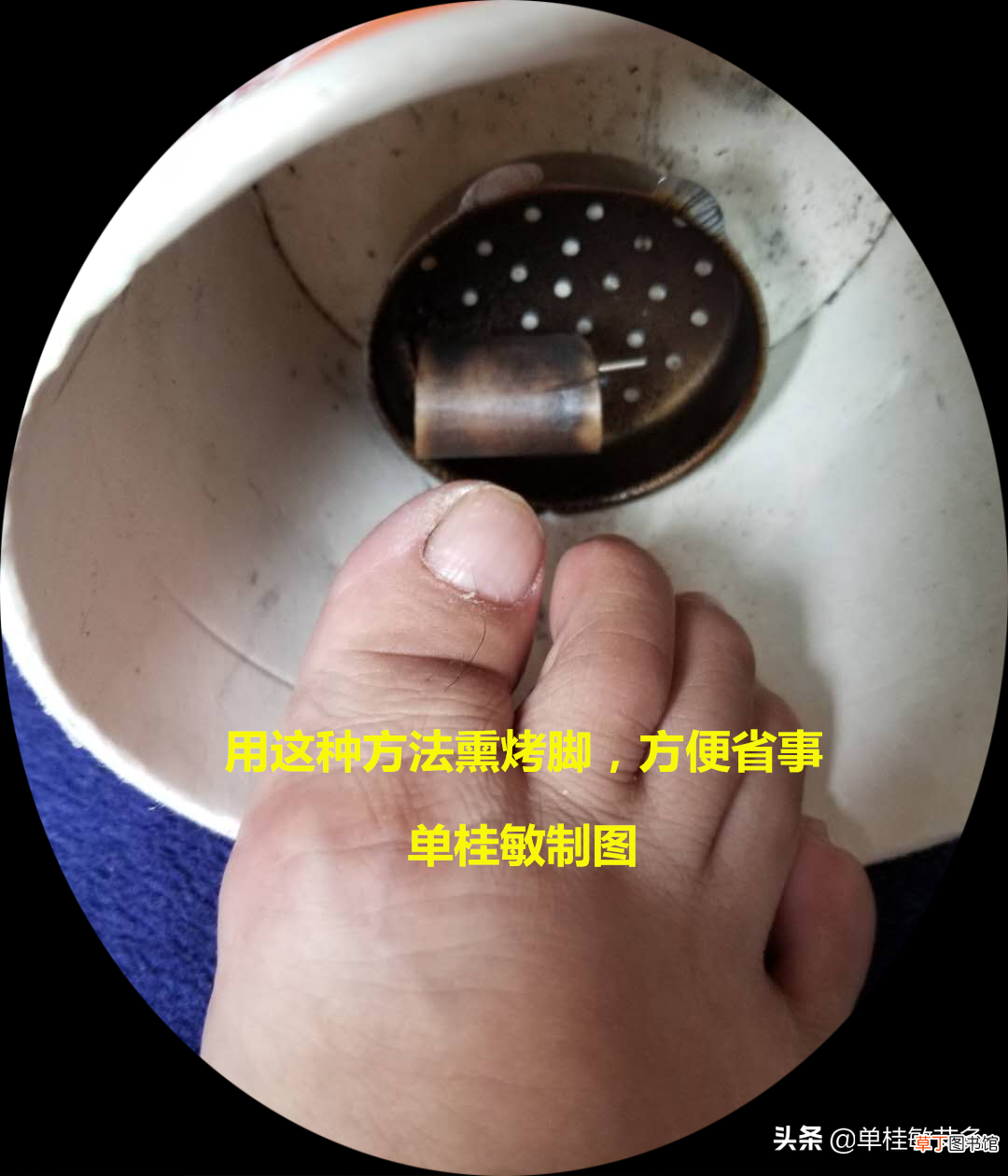 单桂敏艾灸博客 用艾灸治疗甲沟炎，灰指甲，方法简单