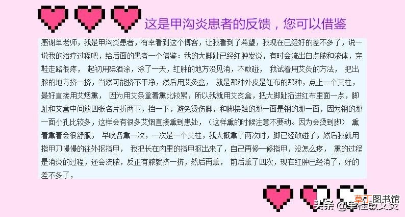 单桂敏艾灸博客 用艾灸治疗甲沟炎，灰指甲，方法简单