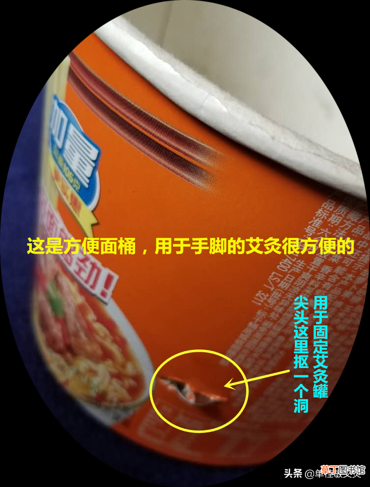 单桂敏艾灸博客 用艾灸治疗甲沟炎，灰指甲，方法简单