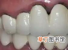 鸡腿蒸20分钟能熟吗 蒸鸡肉要多久