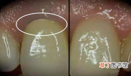 鸡腿蒸20分钟能熟吗 蒸鸡肉要多久